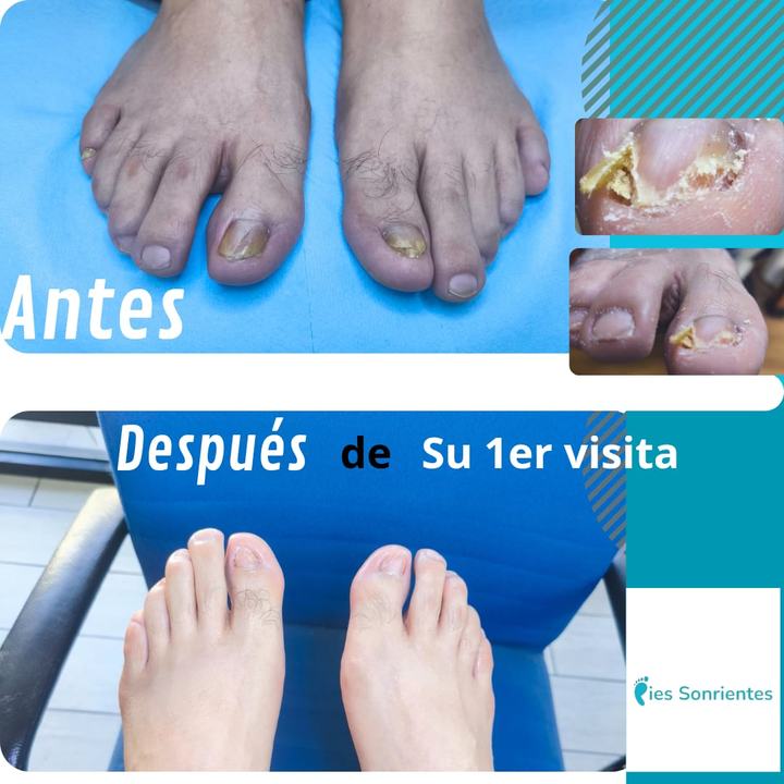 Antes y después de la primera visita